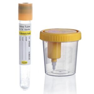 90ml Sterile Vacuum Urine Container+10.5ml Urine Tube