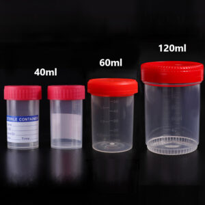 40ml-120ml PP Urine Specimen Container